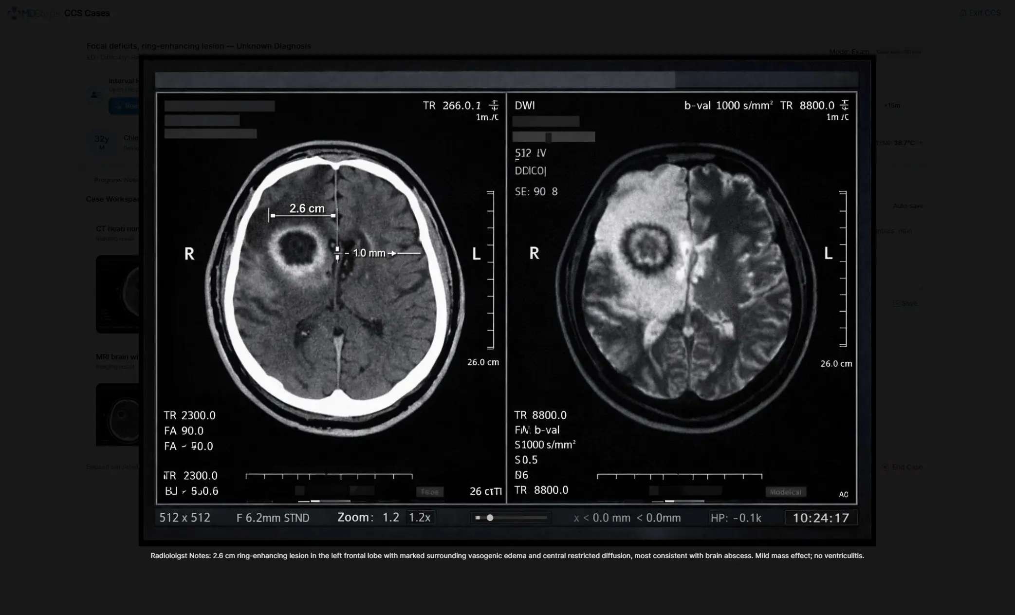 MDSteps CCS case screen showing imaging results, consult updates, and new clinical information during a case