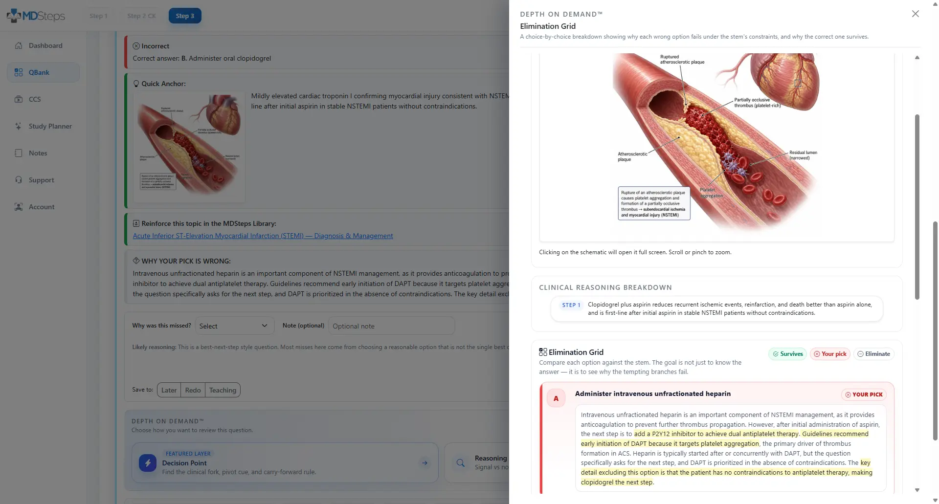 Depth-on-Demand USMLE question review layout showing layered reasoning.