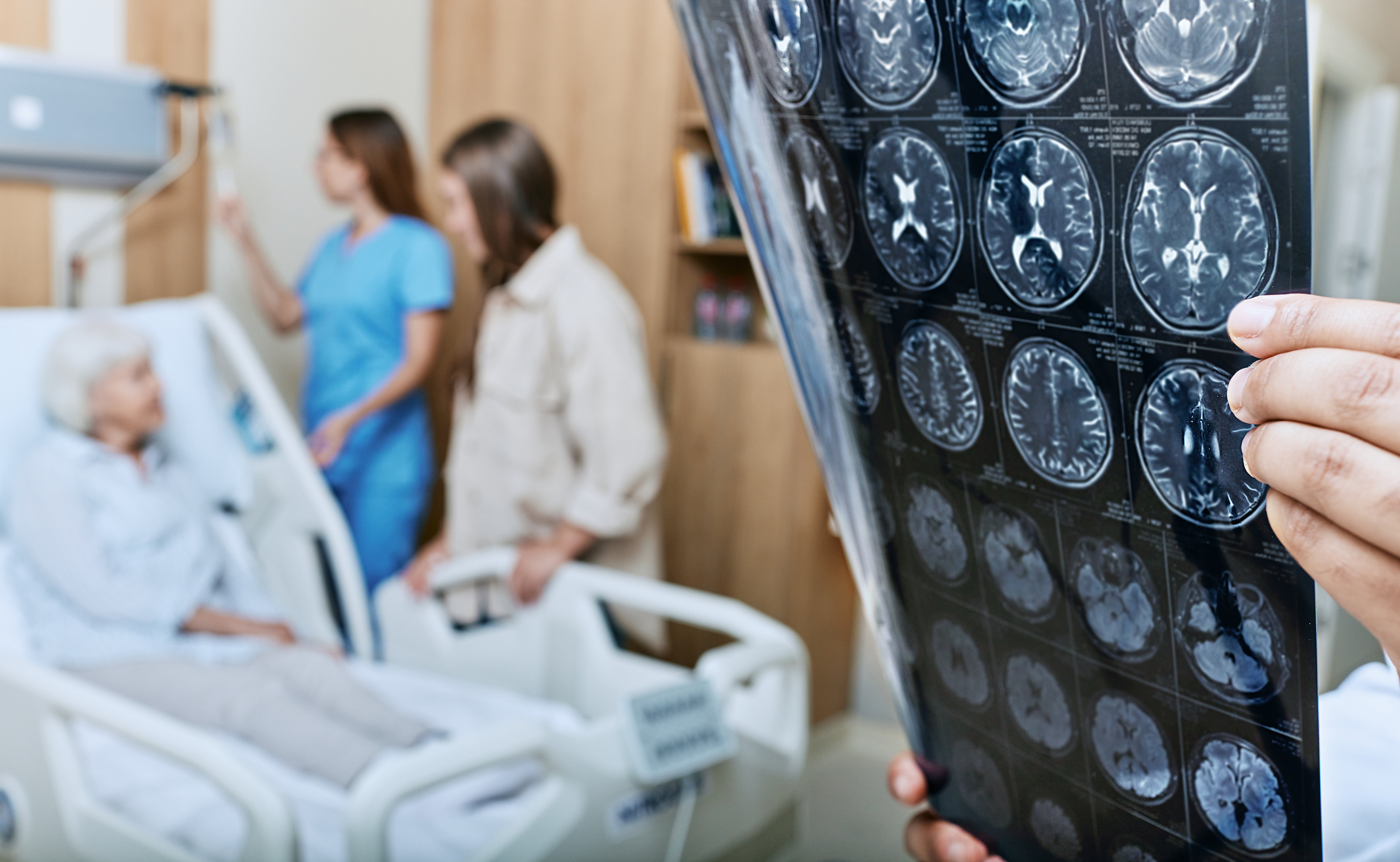 Acute Stroke in the ED: tPA, Thrombectomy, and Pitfalls.