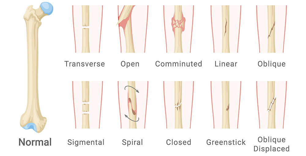 MSK Imaging Decoded: Read the Films the Way Exam Writers Do